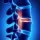 disc-pain-patients-1 An x-ray style that shows the vertebrae discs in red highlight inside a human body.